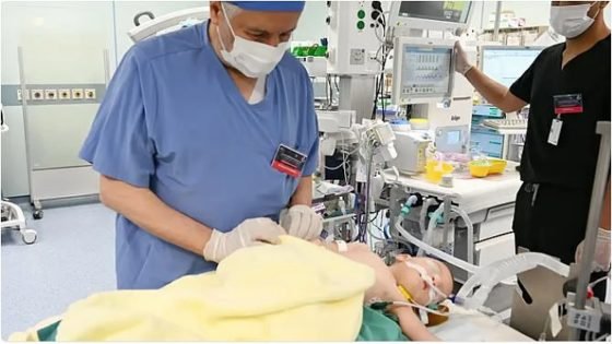 أكثر من 60 عملية فصل ناجحة.. المملكة تتصدر «طب المعجزات» عالميا – القاهرة تايمز